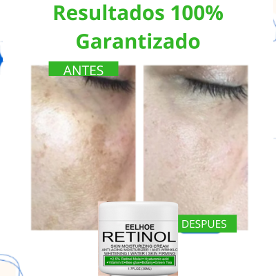 CREMA ACLARADORA WHITENING®