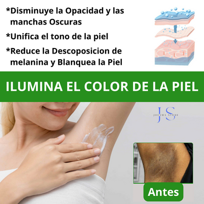 CREMA ACLARADORA WHITENING®